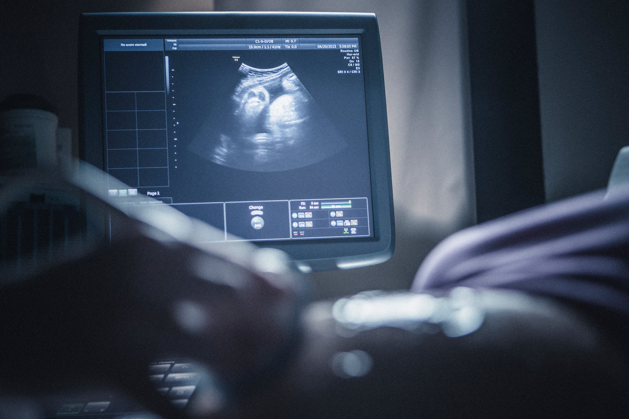 Ankuran - Kolkata's top fertility center with advanced imaging for infertility treatment