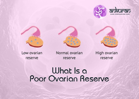 What Is Poor Ovarian Reserve (JPEG Image, 475 x 338 Pixel)