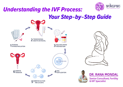Understanding the IVF Process