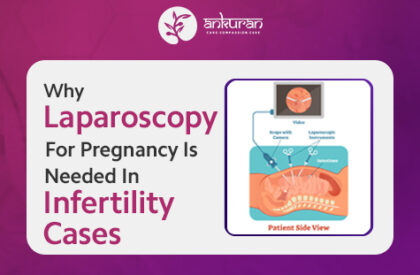 Why Laparoscopy for Pregnancy Is Needed in Infertility Cases