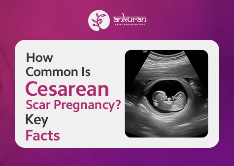 How Common Is Cesarean Scar Pregnancy