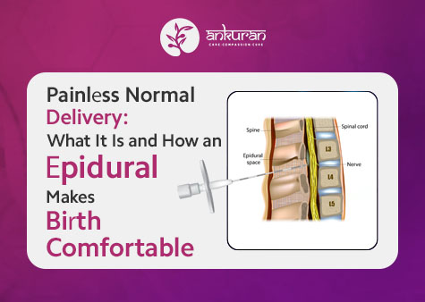 Painless Normal Delivery: What It Is and How an Epidural Makes Birth Comfortable