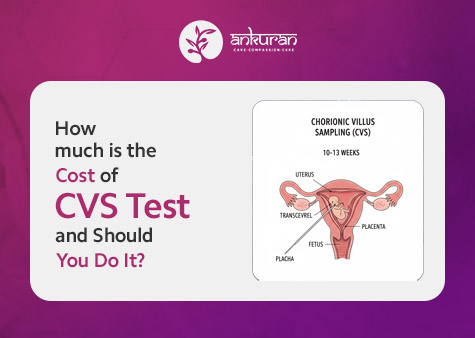 How Much Is the Cost of CVS Test